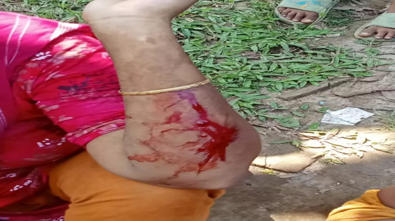 মির্জাপুরে প্রতিপক্ষের হামলায় নারীসহ ৪ জন আহত...