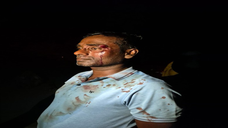 সাবেক ভাইস চেয়ারম্যান শিবলী সাদিকের বিরুদ্ধে হামলার অভিযোগ